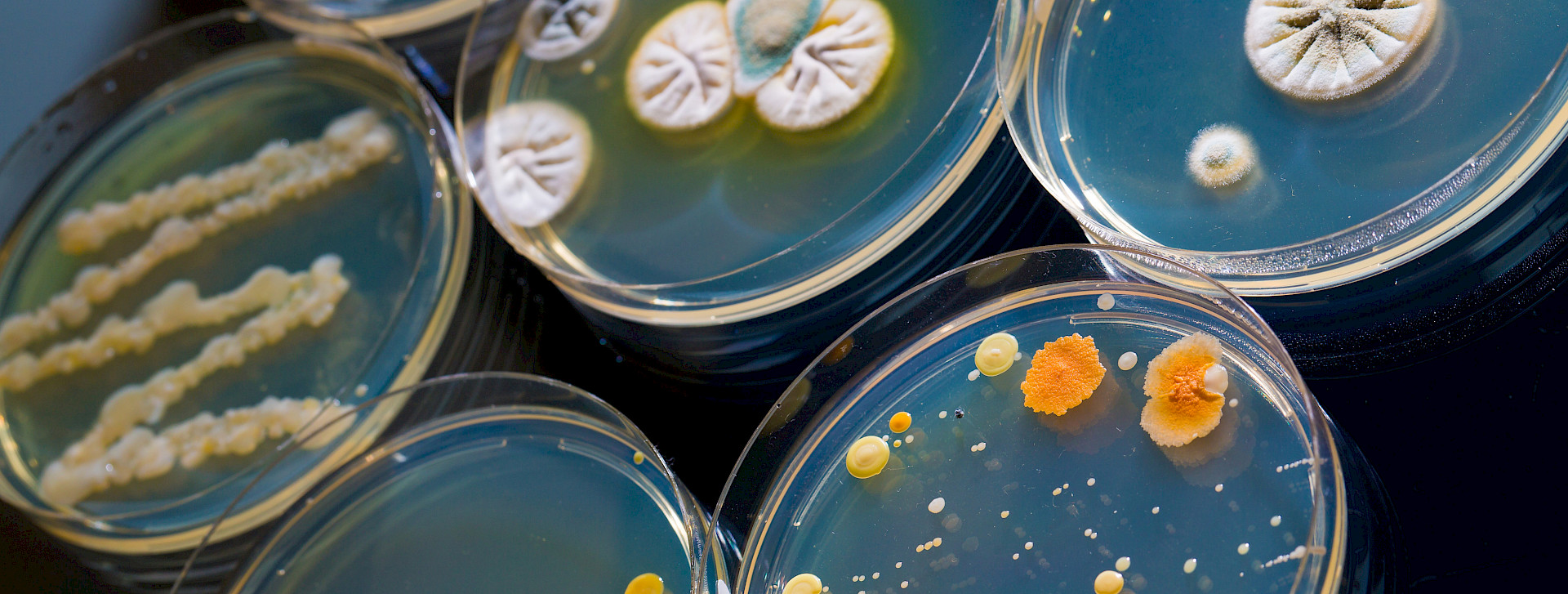 Petrischale mit wachsenden Kulturen von Mikroorganismen und Pilzen