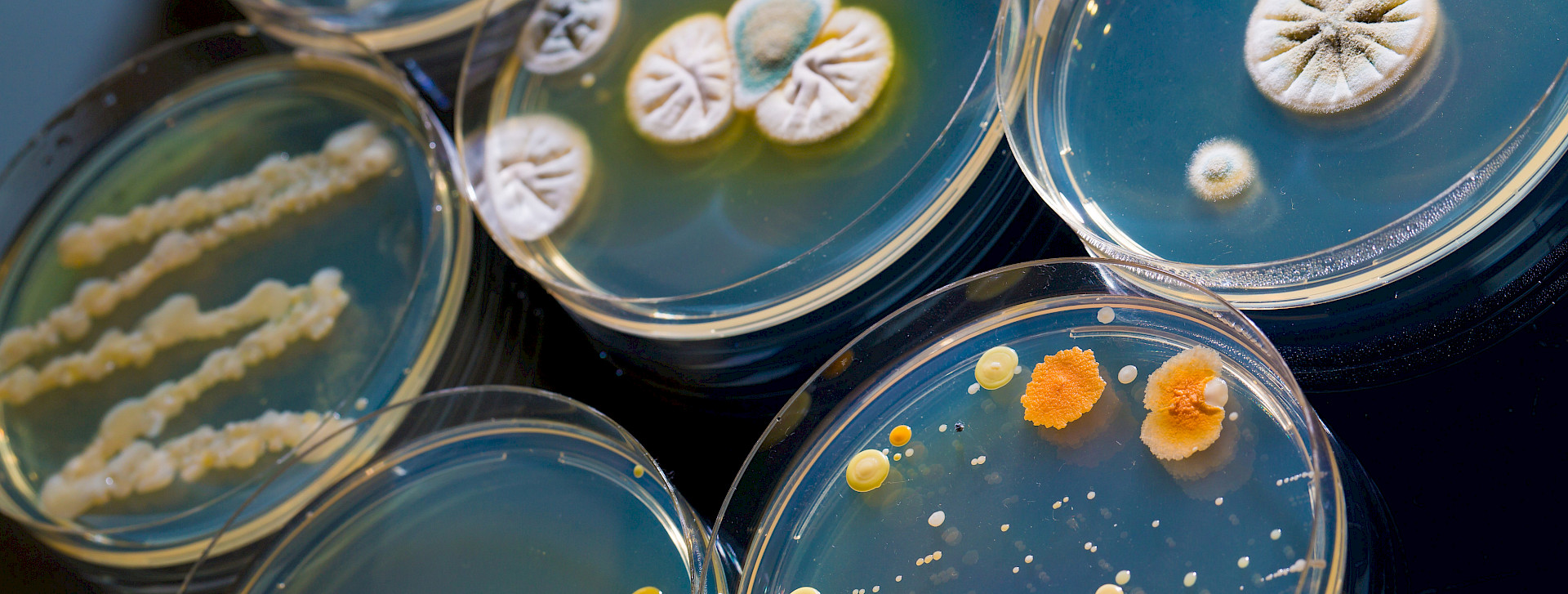 Petri dish with growing cultures of microorganisms and moulds